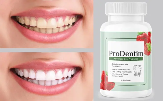 prodentim supplement - before - after - image